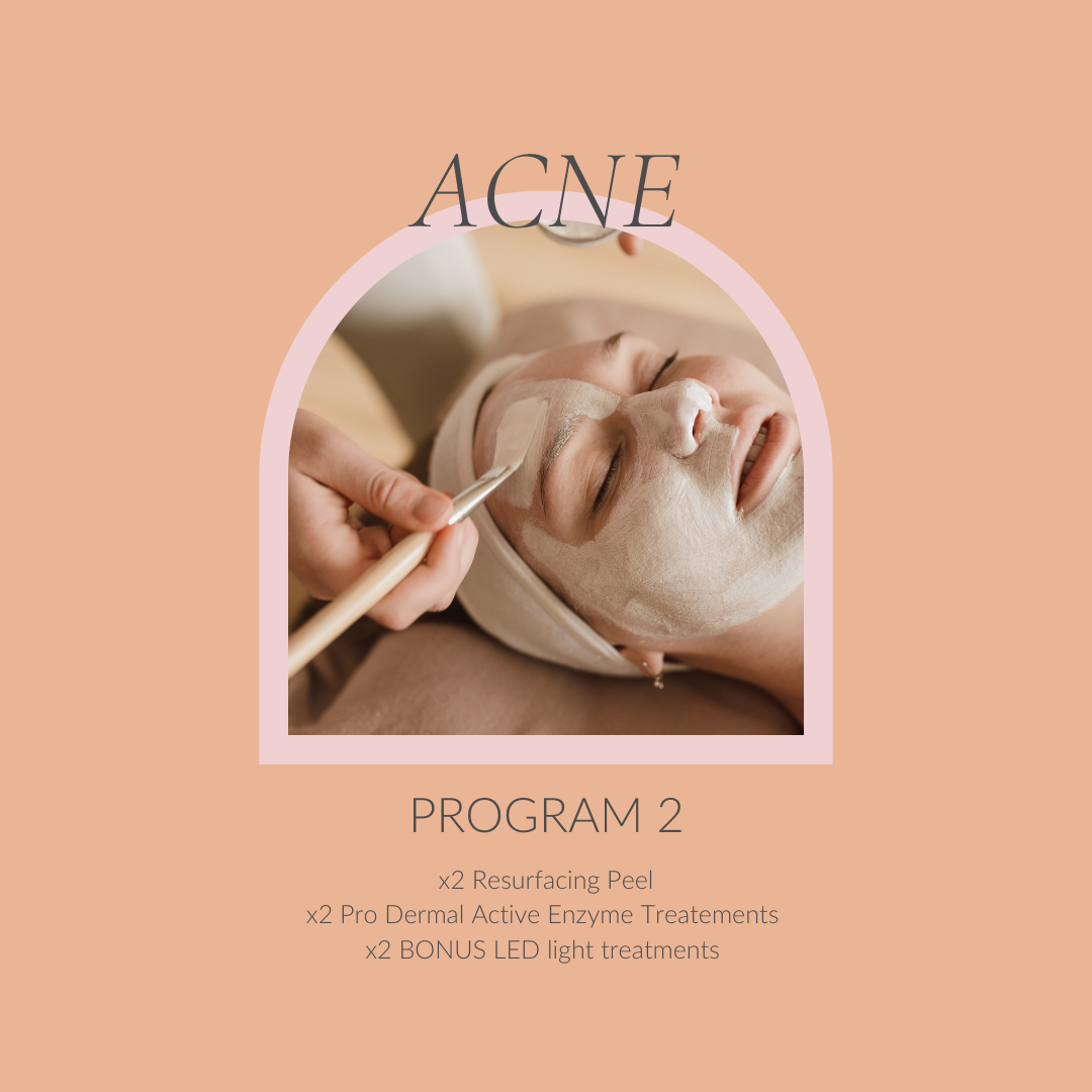 Acne Program 2